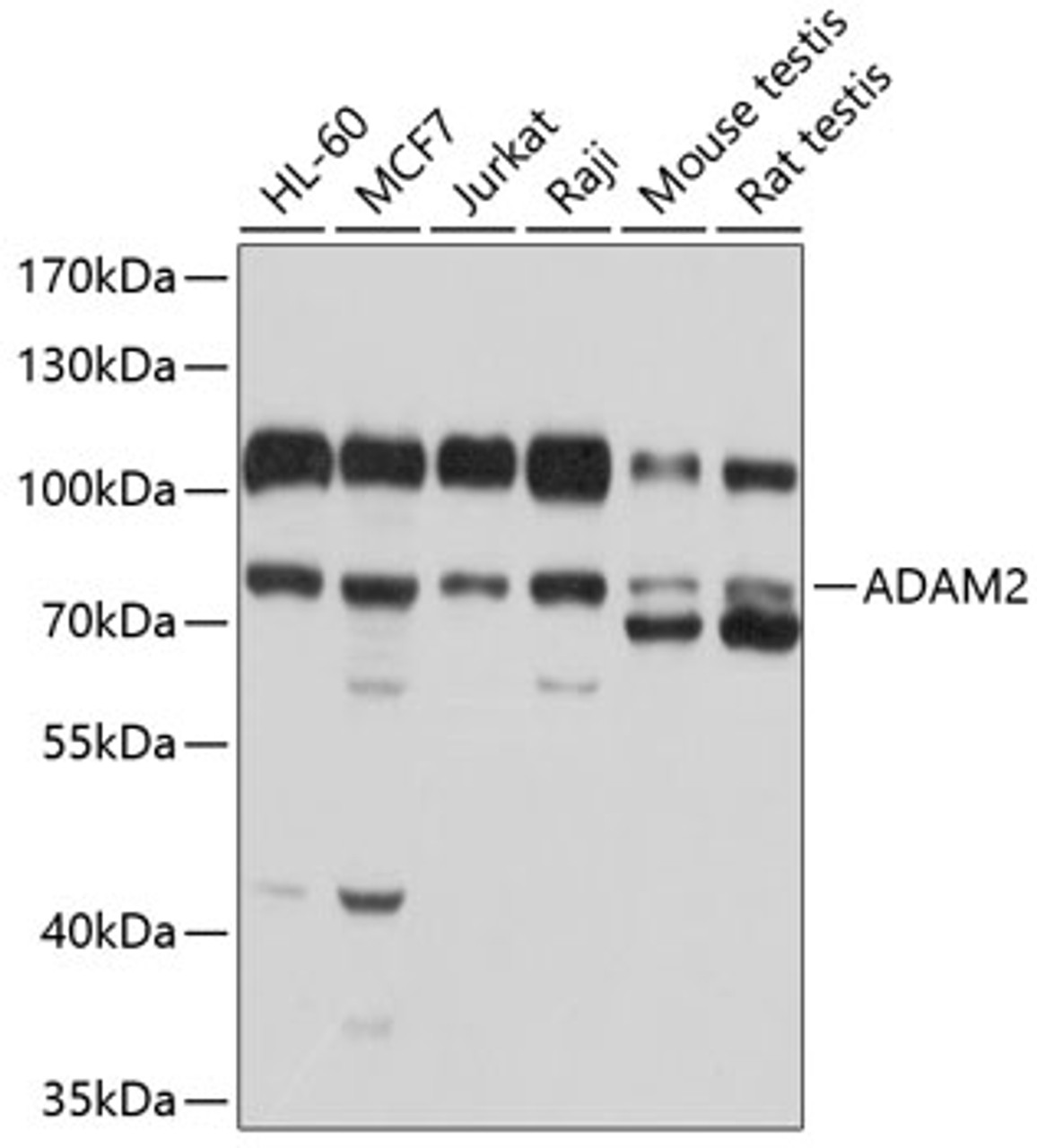 Western blot analysis of extracts of various cell lines, using ADAM2 antibody (13-486) at 1:1000 dilution.<br/>Secondary antibody: HRP Goat Anti-Rabbit IgG (H+L) at 1:10000 dilution.<br/>Lysates/proteins: 25ug per lane.<br/>Blocking buffer: 3% nonfat dry milk in TBST.<br/>Detection: ECL Basic Kit.<br/>Exposure time: 1s.