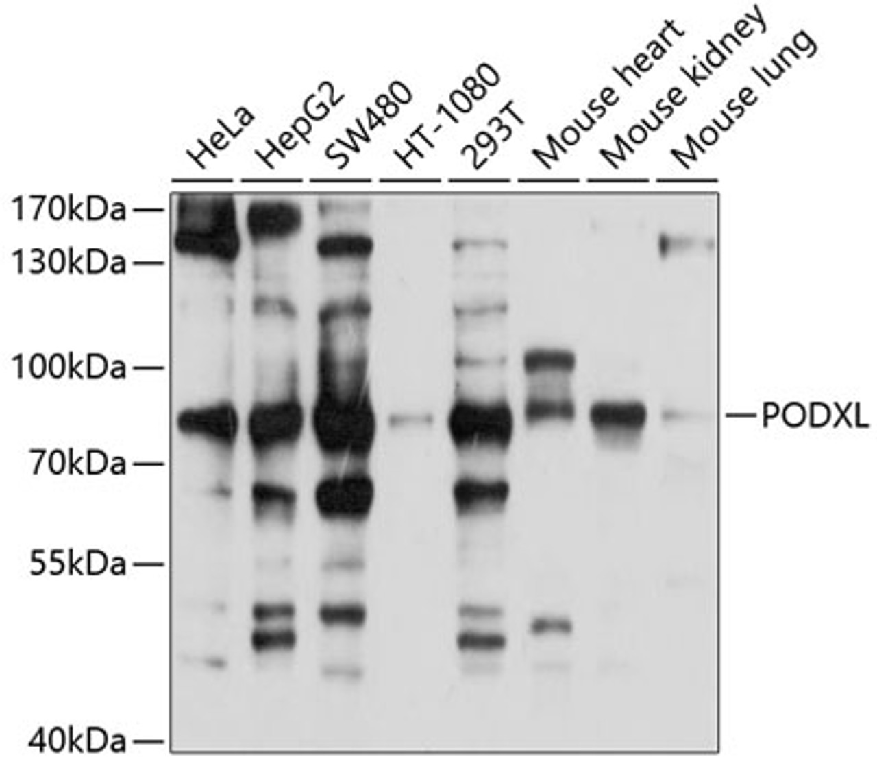 Western blot analysis of extracts of various cell lines, using PODXL antibody (13-496) at 1:1000 dilution.<br/>Secondary antibody: HRP Goat Anti-Rabbit IgG (H+L) at 1:10000 dilution.<br/>Lysates/proteins: 25ug per lane.<br/>Blocking buffer: 3% nonfat dry milk in TBST.<br/>Detection: ECL Basic Kit.<br/>Exposure time: 3s.