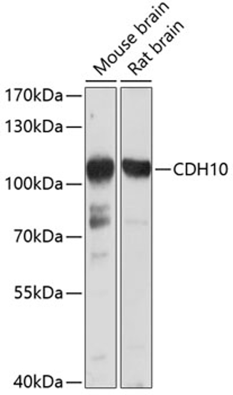 Western blot analysis of extracts of various cell lines, using CDH10 antibody (13-498) at 1:1000 dilution._Secondary antibody: HRP Goat Anti-Rabbit IgG (H+L) at 1:10000 dilution._Lysates/proteins: 25ug per lane._Blocking buffer: 3% nonfat dry milk in TBST._Detection: ECL Basic Kit._Exposure time: 10s.