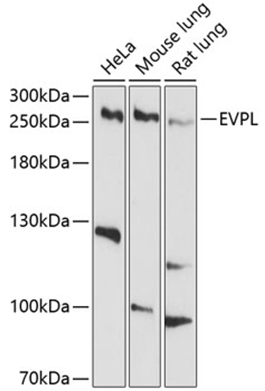 Western blot analysis of extracts of various cell lines, using EVPL antibody (13-507) at 1:1000 dilution.<br/>Secondary antibody: HRP Goat Anti-Rabbit IgG (H+L) at 1:10000 dilution.<br/>Lysates/proteins: 25ug per lane.<br/>Blocking buffer: 3% nonfat dry milk in TBST.<br/>Detection: ECL Basic Kit.<br/>Exposure time: 90s.