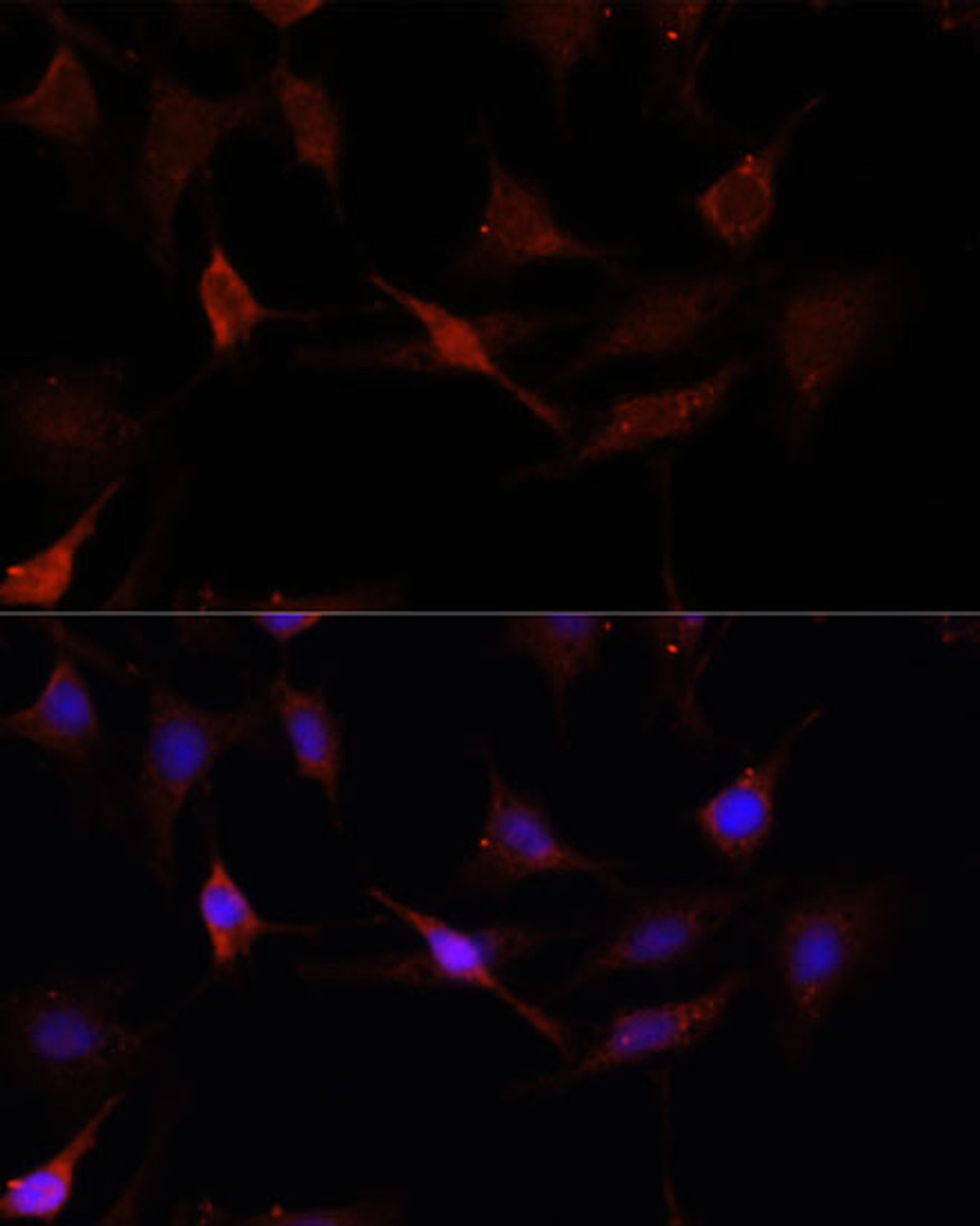 Immunofluorescence analysis of C6 cells using GPER1 antibody (13-509) at dilution of 1:100. Blue: DAPI for nuclear staining.