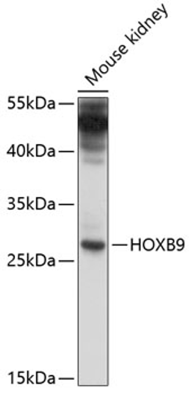 Western blot analysis of extracts of mouse kidney, using HOXB9 antibody (13-514) at 1:1000 dilution.<br/>Secondary antibody: HRP Goat Anti-Rabbit IgG (H+L) at 1:10000 dilution.<br/>Lysates/proteins: 25ug per lane.<br/>Blocking buffer: 3% nonfat dry milk in TBST.<br/>Detection: ECL Enhanced Kit.<br/>Exposure time: 30s.