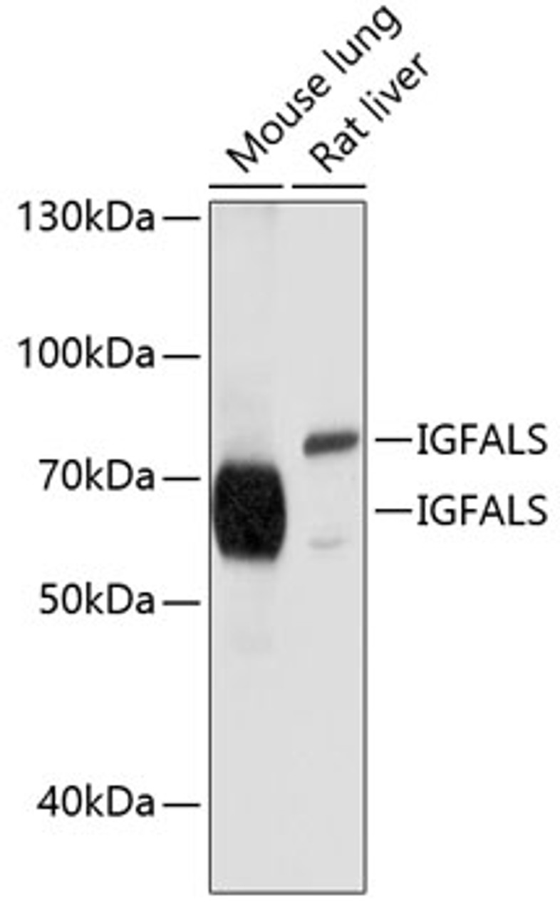 Western blot analysis of extracts of various cell lines, using IGFALS antibody (13-515) at 1:1000 dilution.<br/>Secondary antibody: HRP Goat Anti-Rabbit IgG (H+L) at 1:10000 dilution.<br/>Lysates/proteins: 25ug per lane.<br/>Blocking buffer: 3% nonfat dry milk in TBST.<br/>Detection: ECL Basic Kit.<br/>Exposure time: 1s.