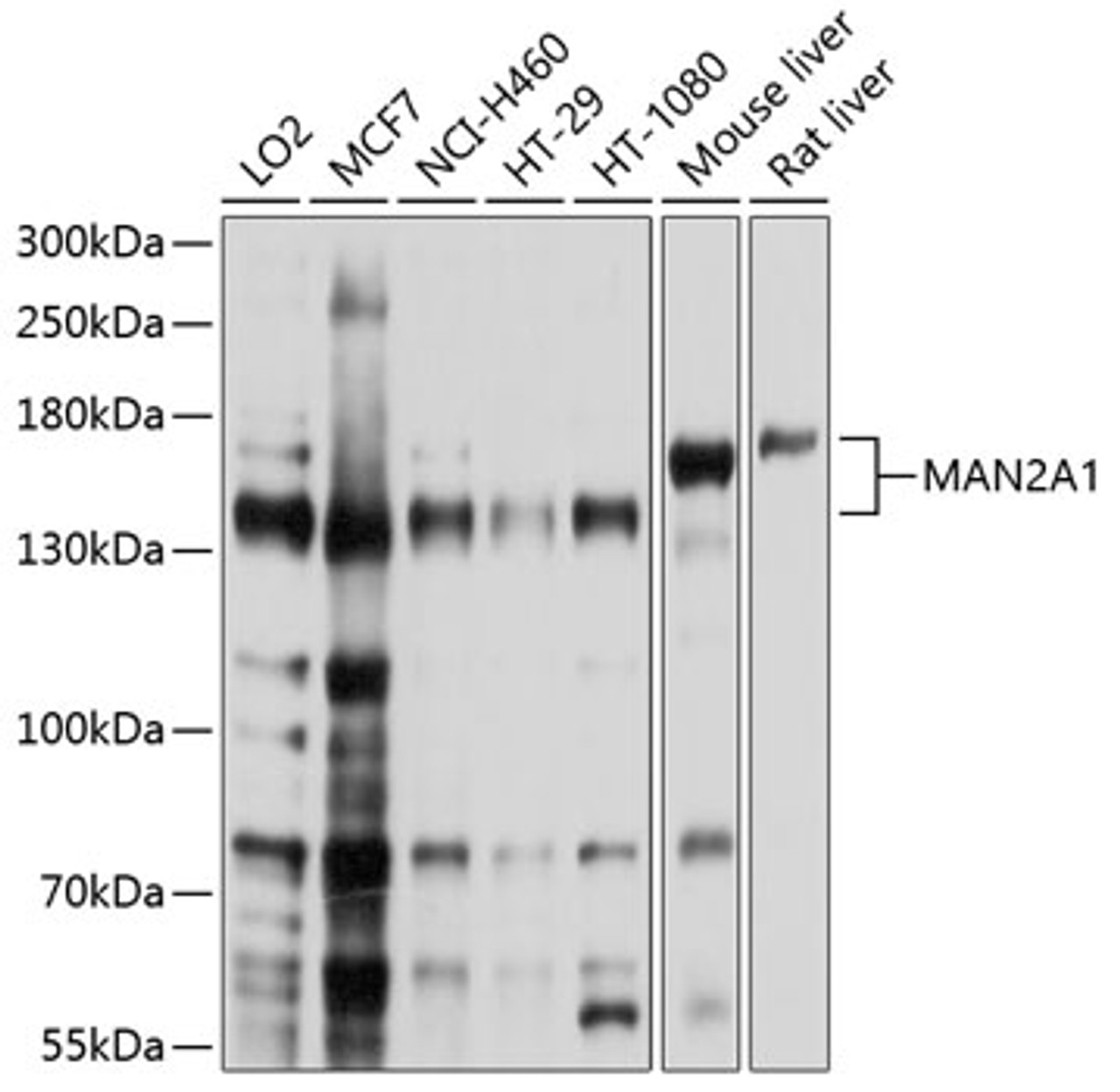 Western blot analysis of extracts of various cell lines, using MAN2A1 antibody (13-516) at 1:1000 dilution.<br/>Secondary antibody: HRP Goat Anti-Rabbit IgG (H+L) at 1:10000 dilution.<br/>Lysates/proteins: 25ug per lane.<br/>Blocking buffer: 3% nonfat dry milk in TBST.<br/>Detection: ECL Basic Kit.<br/>Exposure time: 1s.