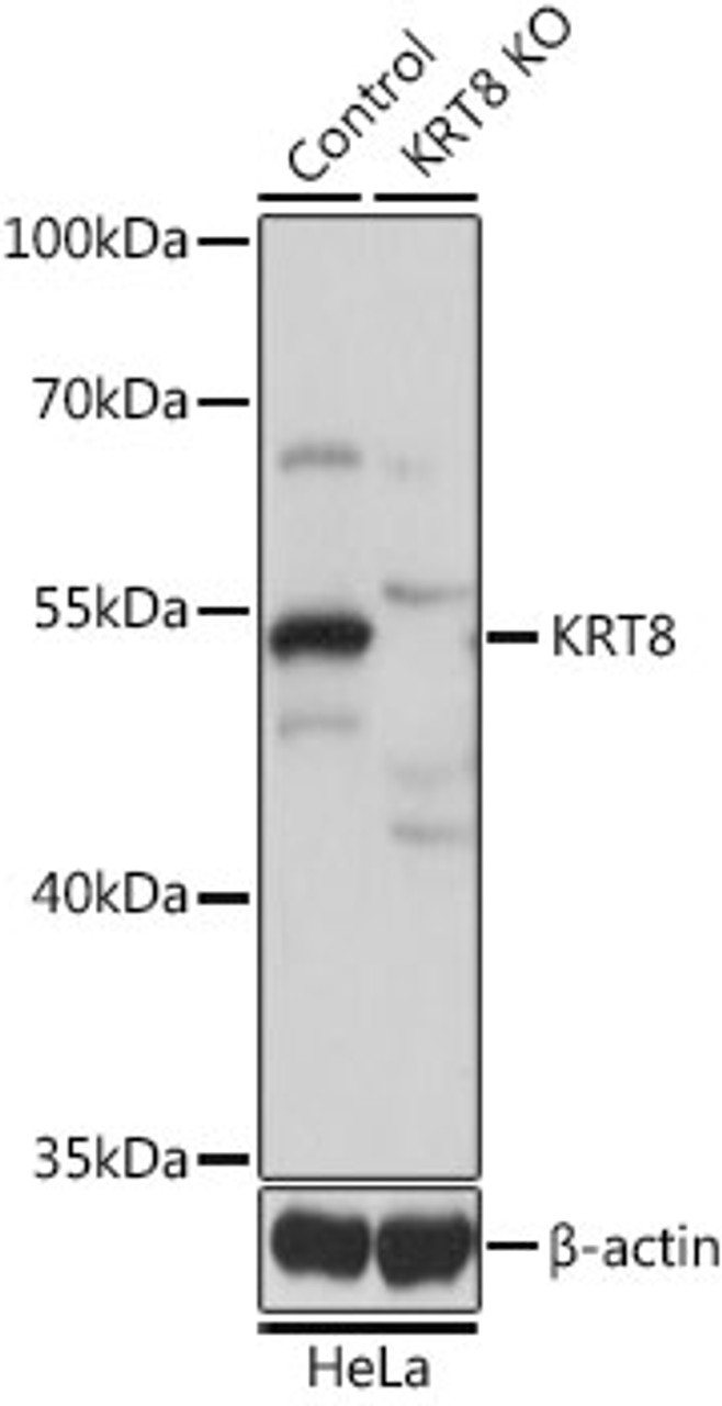 Western blot analysis of extracts from normal (control) and KRT8 knockout (KO) HeLa cells, using KRT8 antibody (13-522) at 1:1000 dilution.<br/>Secondary antibody: HRP Goat Anti-Rabbit IgG (H+L) at 1:10000 dilution.<br/>Lysates/proteins: 25ug per lane.<br/>Blocking buffer: 3% nonfat dry milk in TBST.<br/>Detection: ECL Basic Kit.<br/>Exposure time: 1s.