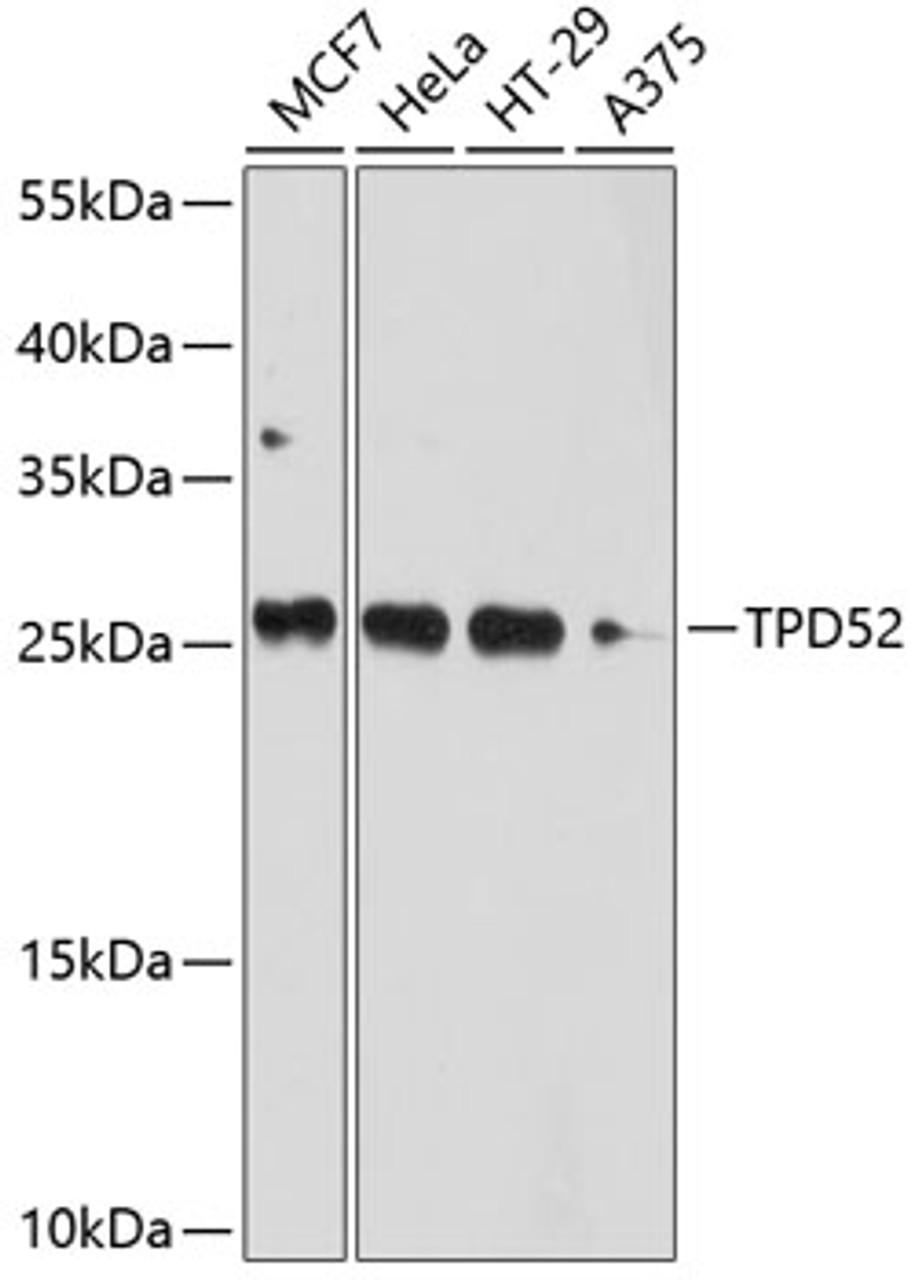 Western blot analysis of extracts of various cell lines, using TPD52 antibody (13-535) at 1:1000 dilution.<br/>Secondary antibody: HRP Goat Anti-Rabbit IgG (H+L) at 1:10000 dilution.<br/>Lysates/proteins: 25ug per lane.<br/>Blocking buffer: 3% nonfat dry milk in TBST.<br/>Detection: ECL Basic Kit.<br/>Exposure time: 10s.