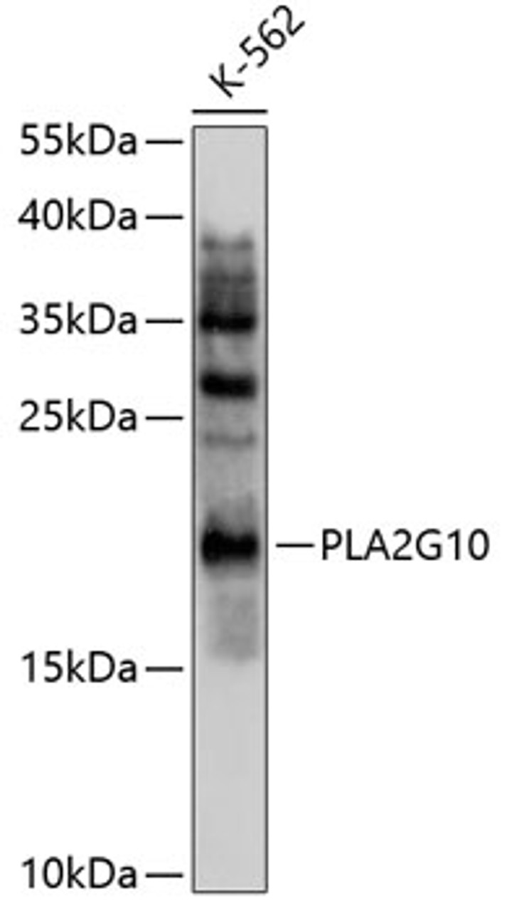 Western blot analysis of extracts of K562 cells, using PLA2G10 antibody (13-537) at 1:1000 dilution.<br/>Secondary antibody: HRP Goat Anti-Rabbit IgG (H+L) at 1:10000 dilution.<br/>Lysates/proteins: 25ug per lane.<br/>Blocking buffer: 3% nonfat dry milk in TBST.<br/>Detection: ECL Basic Kit.<br/>Exposure time: 90s.
