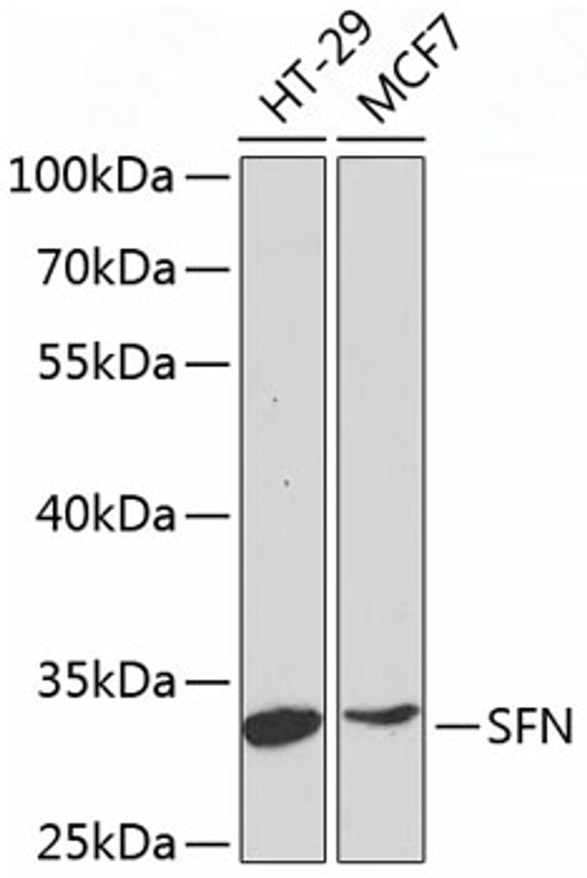 Western blot analysis of extracts of various cell lines, using SFN antibody (13-540) at 1:1000 dilution.<br/>Secondary antibody: HRP Goat Anti-Rabbit IgG (H+L) at 1:10000 dilution.<br/>Lysates/proteins: 25ug per lane.<br/>Blocking buffer: 3% nonfat dry milk in TBST.