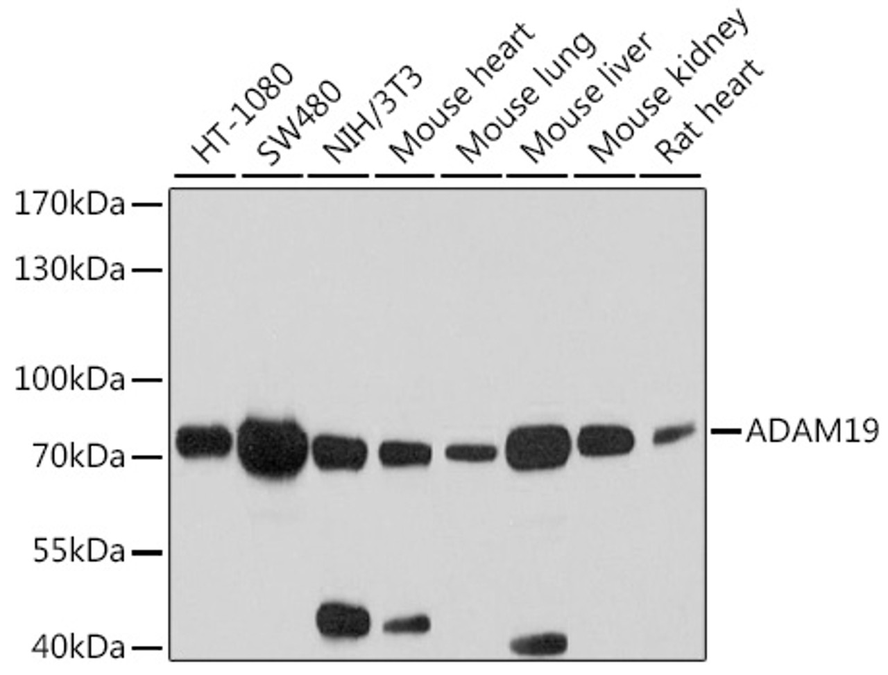 Western blot analysis of extracts of various cell lines, using ADAM19 antibody (13-541) at 1:2000 dilution.<br/>Secondary antibody: HRP Goat Anti-Rabbit IgG (H+L) at 1:10000 dilution.<br/>Lysates/proteins: 25ug per lane.<br/>Blocking buffer: 3% nonfat dry milk in TBST.<br/>Detection: ECL Basic Kit.<br/>Exposure time: 30s.