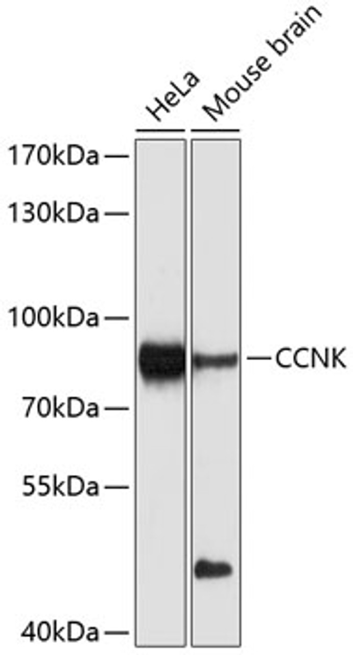 Western blot analysis of extracts of various cell lines, using CCNK Antibody (13-542) at 1:1000 dilution.<br/>Secondary antibody: HRP Goat Anti-Rabbit IgG (H+L) at 1:10000 dilution.<br/>Lysates/proteins: 25ug per lane.<br/>Blocking buffer: 3% nonfat dry milk in TBST.<br/>Detection: ECL Enhanced Kit.<br/>Exposure time: 90s.