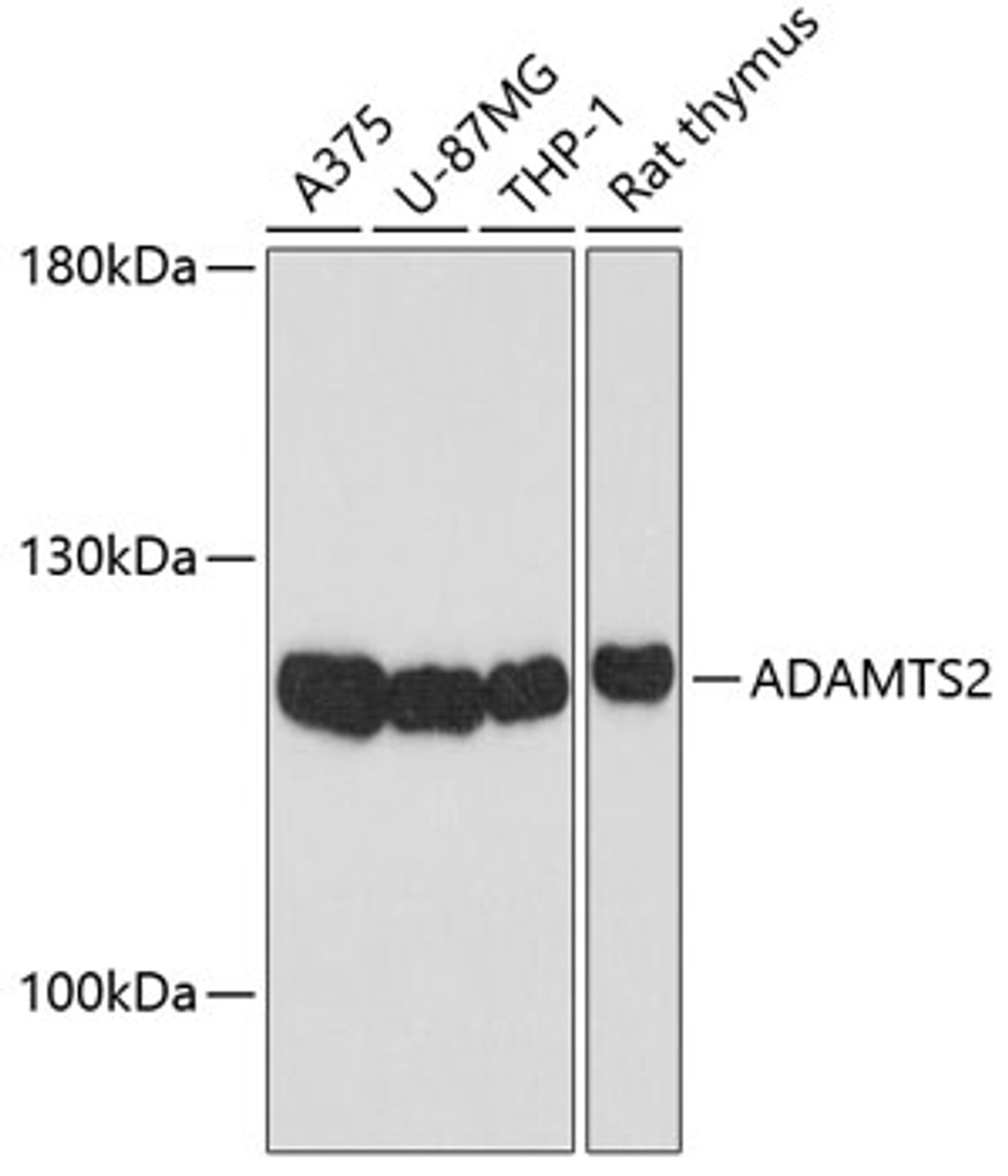 Western blot analysis of extracts of various cell lines, using ADAMTS2 Antibody (13-548) at 1:1000 dilution.<br/>Secondary antibody: HRP Goat Anti-Rabbit IgG (H+L) at 1:10000 dilution.<br/>Lysates/proteins: 25ug per lane.<br/>Blocking buffer: 3% nonfat dry milk in TBST.<br/>Detection: ECL Basic Kit.<br/>Exposure time: 30s.