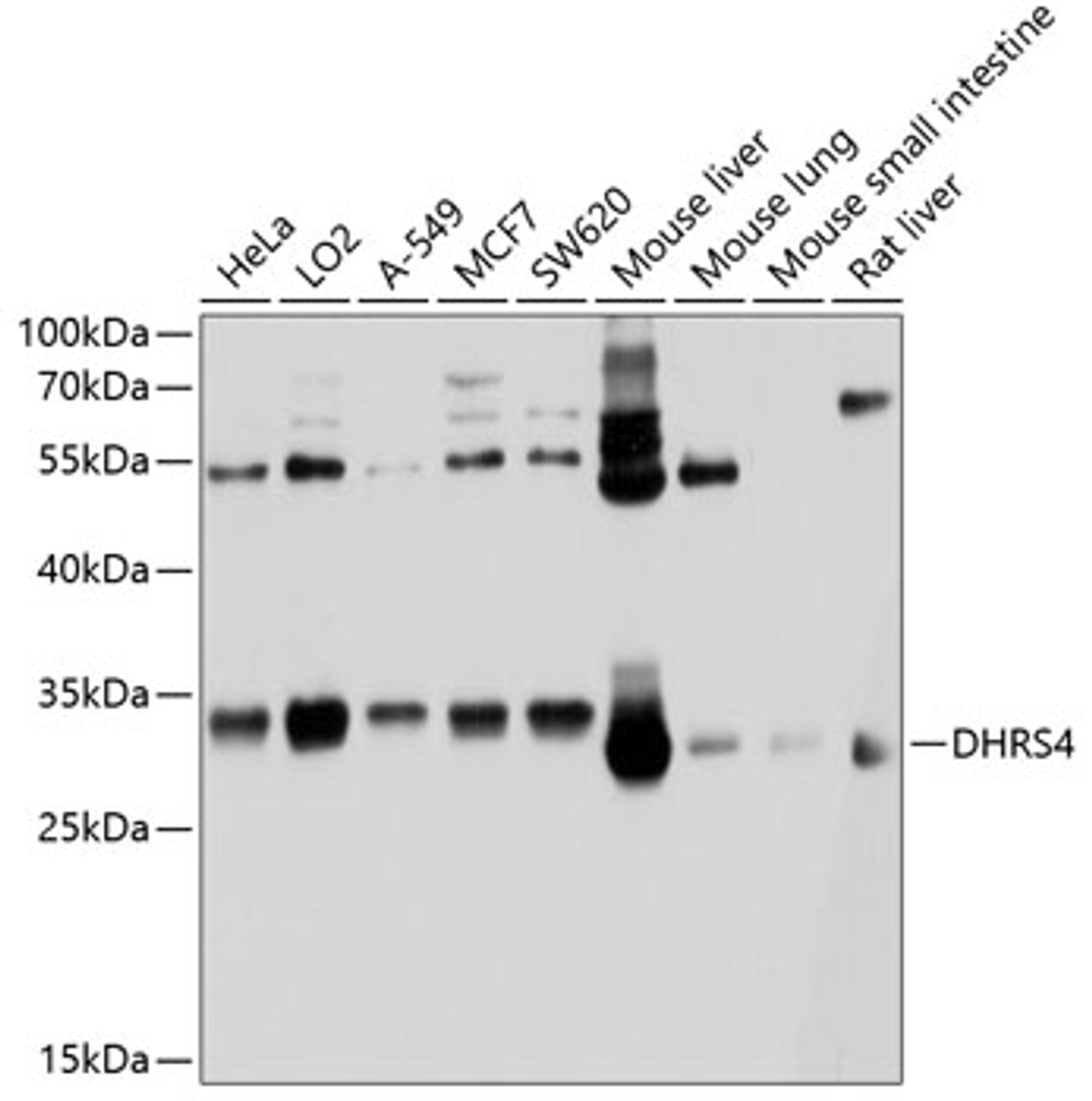 Western blot analysis of extracts of various cell lines, using DHRS4 antibody (13-554) at 1:1000 dilution.<br/>Secondary antibody: HRP Goat Anti-Rabbit IgG (H+L) at 1:10000 dilution.<br/>Lysates/proteins: 25ug per lane.<br/>Blocking buffer: 3% nonfat dry milk in TBST.<br/>Detection: ECL Basic Kit.<br/>Exposure time: 1s.