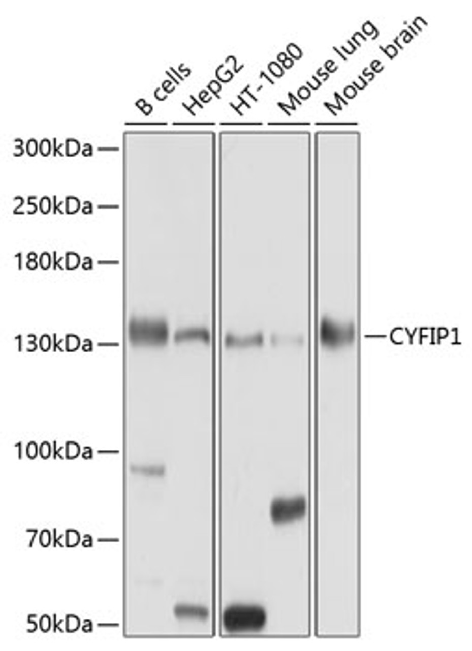 Western blot analysis of extracts of various cell lines, using CYFIP1 antibody (13-560) at 1:1000 dilution.<br/>Secondary antibody: HRP Goat Anti-Rabbit IgG (H+L) at 1:10000 dilution.<br/>Lysates/proteins: 25ug per lane.<br/>Blocking buffer: 3% nonfat dry milk in TBST.<br/>Detection: ECL Basic Kit.<br/>Exposure time: 10s.