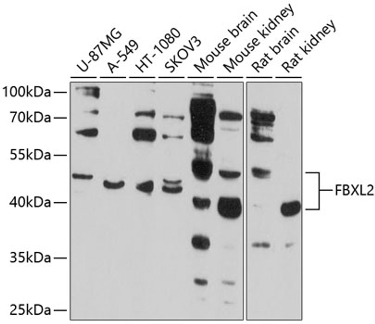 Western blot analysis of extracts of various cell lines, using FBXL2 antibody (13-564) at 1:1000 dilution.<br/>Secondary antibody: HRP Goat Anti-Rabbit IgG (H+L) at 1:10000 dilution.<br/>Lysates/proteins: 25ug per lane.<br/>Blocking buffer: 3% nonfat dry milk in TBST.<br/>Detection: ECL Basic Kit.<br/>Exposure time: 30s.