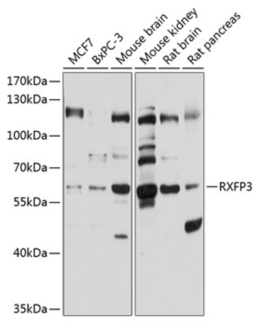 Western blot analysis of extracts of various cell lines, using RXFP3 antibody (13-566) at 1:1000 dilution.<br/>Secondary antibody: HRP Goat Anti-Rabbit IgG (H+L) at 1:10000 dilution.<br/>Lysates/proteins: 25ug per lane.<br/>Blocking buffer: 3% nonfat dry milk in TBST.<br/>Detection: ECL Basic Kit.<br/>Exposure time: 20s.