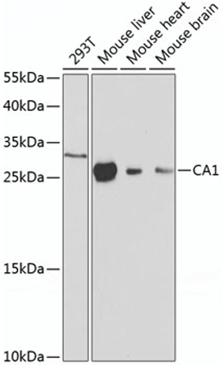 Western blot analysis of extracts of various cell lines, using CA1 antibody (13-570) at 1:1000 dilution.<br/>Secondary antibody: HRP Goat Anti-Rabbit IgG (H+L) at 1:10000 dilution.<br/>Lysates/proteins: 25ug per lane.<br/>Blocking buffer: 3% nonfat dry milk in TBST.<br/>Detection: ECL Basic Kit.<br/>Exposure time: 30s.