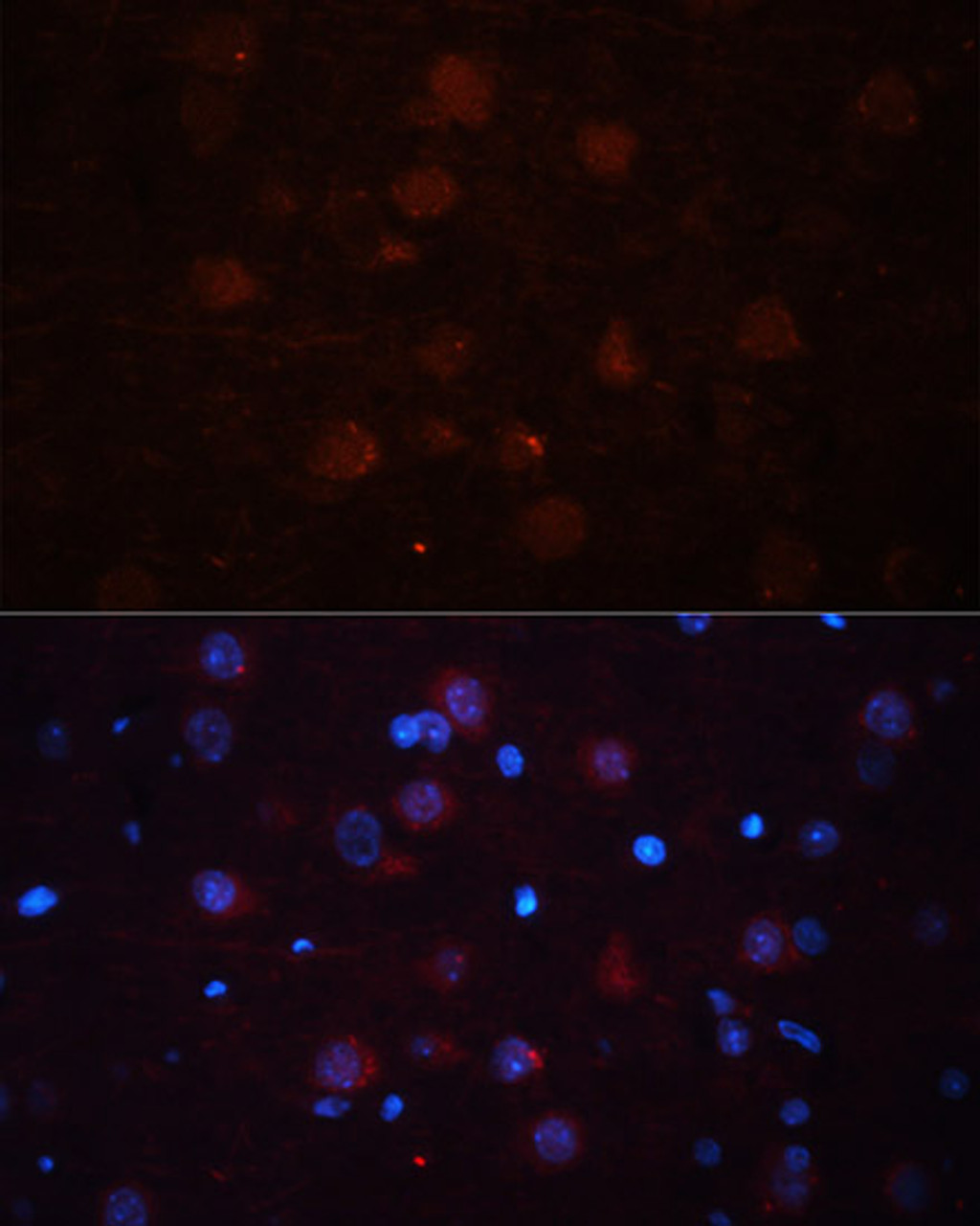 Immunofluorescence analysis of rat brain using ASPN antibody (13-571) at dilution of 1:100 (40x lens) . Blue: DAPI for nuclear staining.