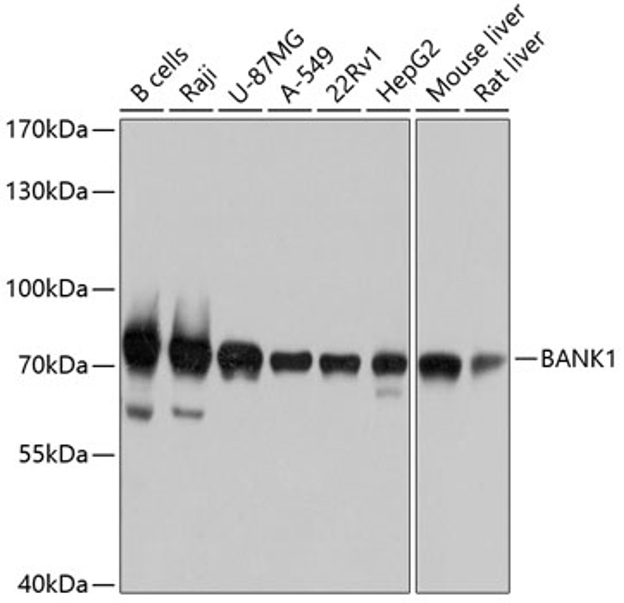 Western blot analysis of extracts of various cell lines, using BANK1 antibody (13-572) at 1:1000 dilution.<br/>Secondary antibody: HRP Goat Anti-Rabbit IgG (H+L) at 1:10000 dilution.<br/>Lysates/proteins: 25ug per lane.<br/>Blocking buffer: 3% nonfat dry milk in TBST.<br/>Detection: ECL Basic Kit.<br/>Exposure time: 3s.