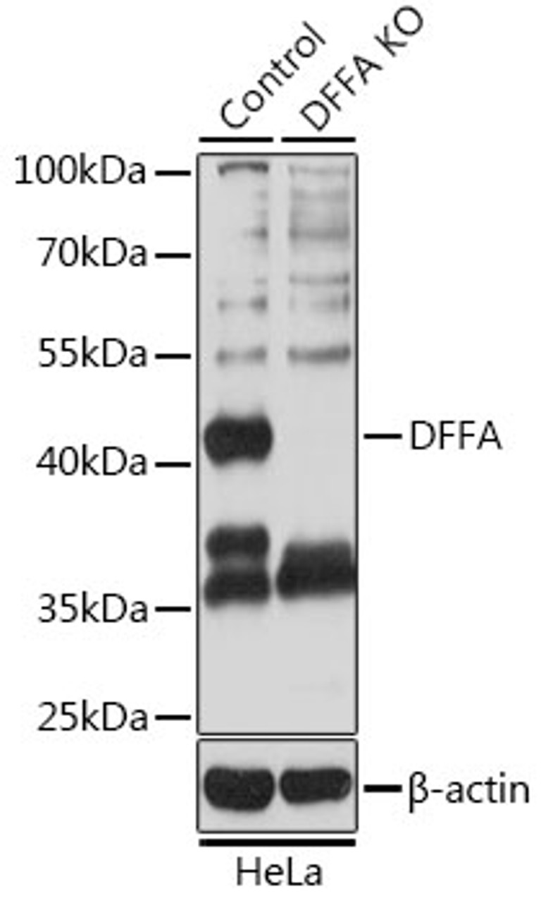 Western blot analysis of extracts from normal (control) and DFFA knockout (KO) HeLa cells, using DFFA antibody (13-578) at 1:3000 dilution.<br/>Secondary antibody: HRP Goat Anti-Rabbit IgG (H+L) at 1:10000 dilution.<br/>Lysates/proteins: 25ug per lane.<br/>Blocking buffer: 3% nonfat dry milk in TBST.<br/>Detection: ECL Basic Kit.<br/>Exposure time: 5s.