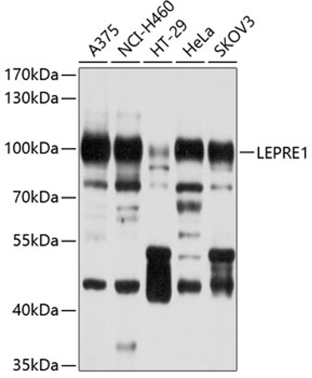 Western blot analysis of extracts of various cell lines, using LEPRE1 antibody (13-580) at 1:1000 dilution.<br/>Secondary antibody: HRP Goat Anti-Rabbit IgG (H+L) at 1:10000 dilution.<br/>Lysates/proteins: 25ug per lane.<br/>Blocking buffer: 3% nonfat dry milk in TBST.<br/>Detection: ECL Basic Kit.<br/>Exposure time: 30s.