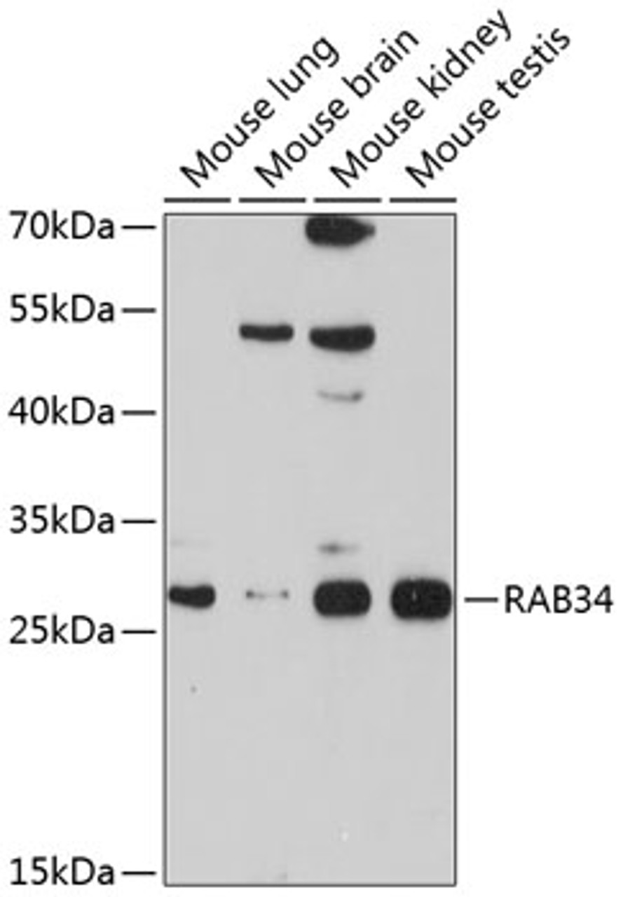 Western blot analysis of extracts of various cell lines, using RAB34 antibody (13-585) at 1:1000 dilution.<br/>Secondary antibody: HRP Goat Anti-Rabbit IgG (H+L) at 1:10000 dilution.<br/>Lysates/proteins: 25ug per lane.<br/>Blocking buffer: 3% nonfat dry milk in TBST.<br/>Detection: ECL Basic Kit.<br/>Exposure time: 90s.