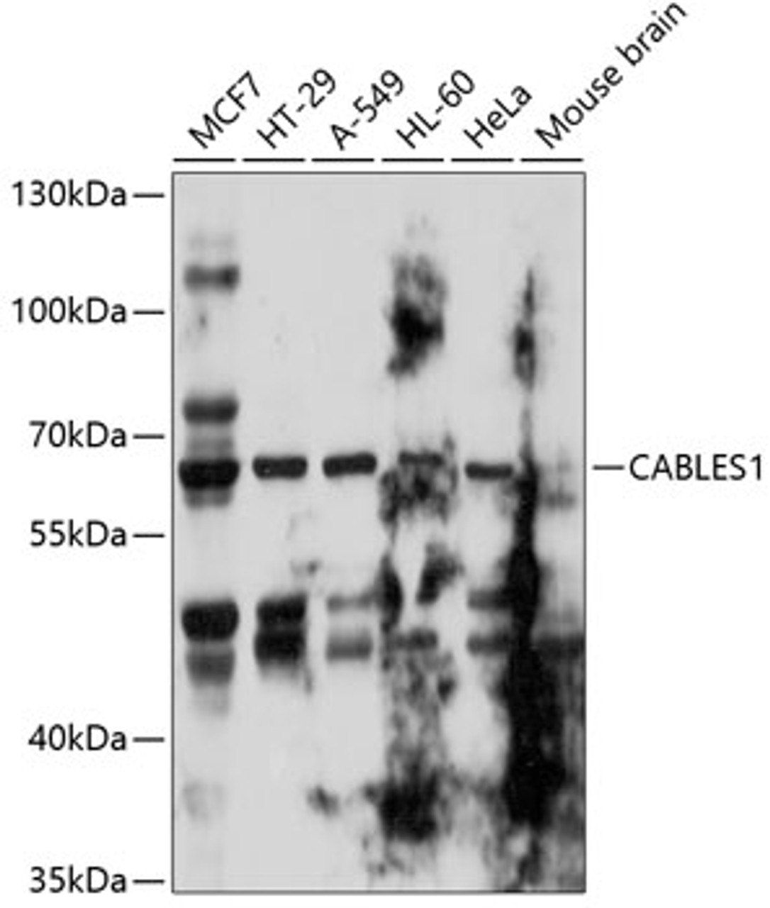 Western blot analysis of extracts of various cell lines, using CABLES1 antibody (13-587) at 1:1000 dilution.<br/>Secondary antibody: HRP Goat Anti-Rabbit IgG (H+L) at 1:10000 dilution.<br/>Lysates/proteins: 25ug per lane.<br/>Blocking buffer: 3% nonfat dry milk in TBST.<br/>Detection: ECL Basic Kit.<br/>Exposure time: 10s.