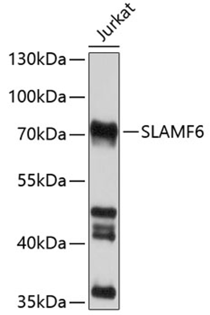 Western blot analysis of extracts of Jurkat cells, using SLAMF6 antibody (13-589) at 1:1000 dilution.<br/>Secondary antibody: HRP Goat Anti-Rabbit IgG (H+L) at 1:10000 dilution.<br/>Lysates/proteins: 25ug per lane.<br/>Blocking buffer: 3% nonfat dry milk in TBST.<br/>Detection: ECL Basic Kit.<br/>Exposure time: 15s.