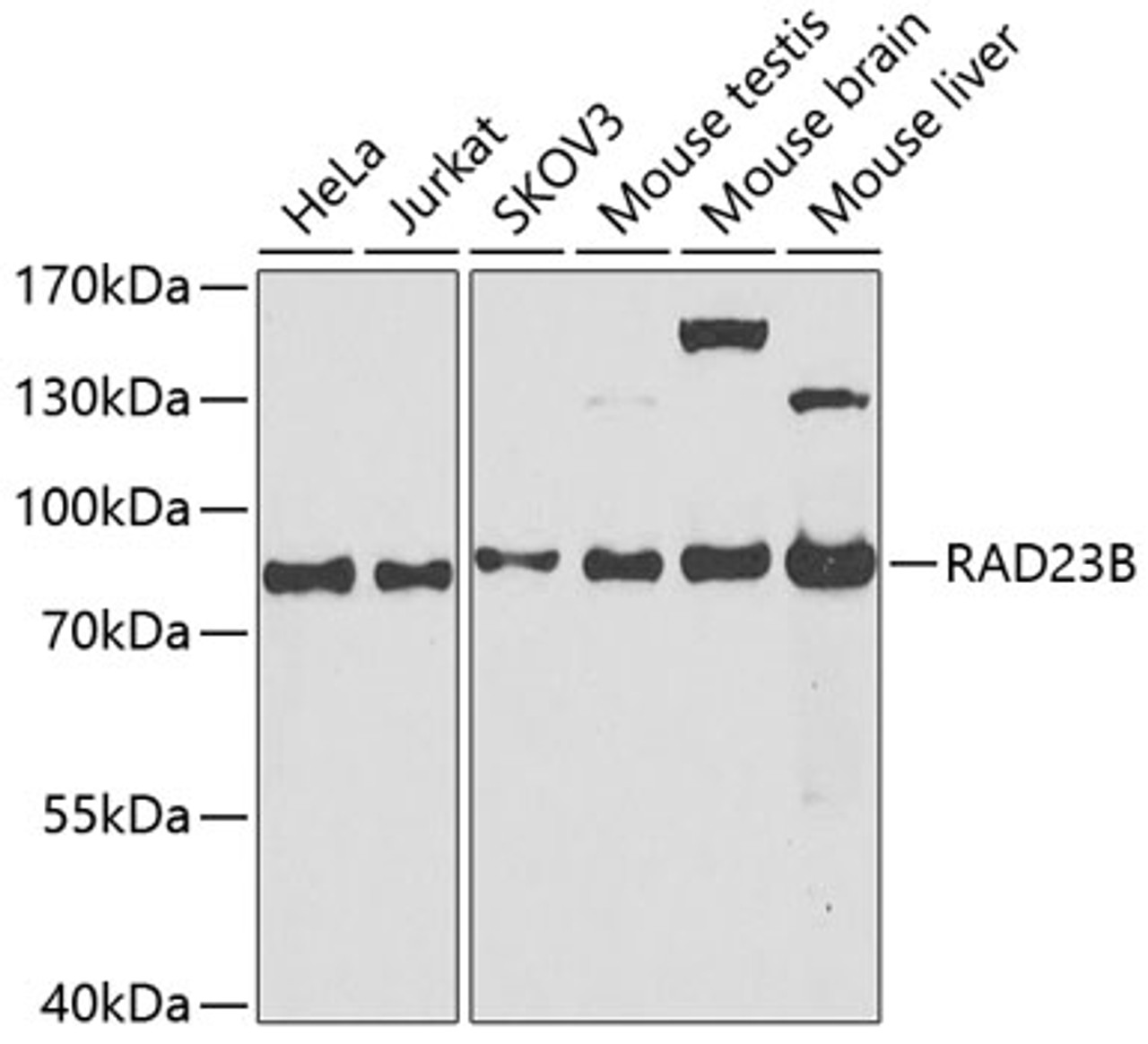 Western blot analysis of extracts of various cell lines, using RAD23B antibody (13-590) at 1:1000 dilution.<br/>Secondary antibody: HRP Goat Anti-Rabbit IgG (H+L) at 1:10000 dilution.<br/>Lysates/proteins: 25ug per lane.<br/>Blocking buffer: 3% nonfat dry milk in TBST.<br/>Detection: ECL Basic Kit.<br/>Exposure time: 90s.