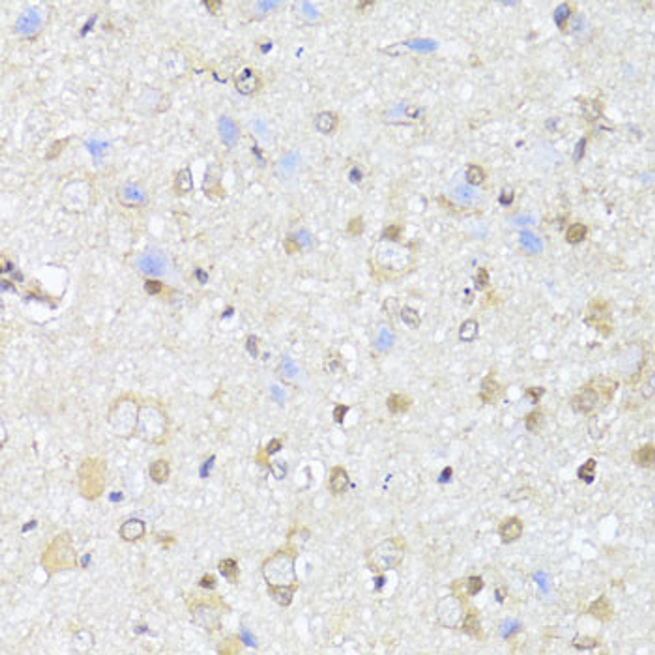 Immunohistochemistry of paraffin-embedded rat brain using EGLN1+EGLN2 antibody (13-591) at dilution of 1:100 (40x lens) .