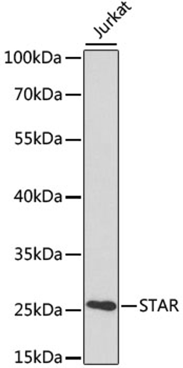 Western blot analysis of extracts of various cell lines, using STAR antibody (13-593) at 1:1000 dilution.<br/>Secondary antibody: HRP Goat Anti-Rabbit IgG (H+L) at 1:10000 dilution.<br/>Lysates/proteins: 25ug per lane.<br/>Blocking buffer: 3% nonfat dry milk in TBST.<br/>Detection: ECL Basic Kit.