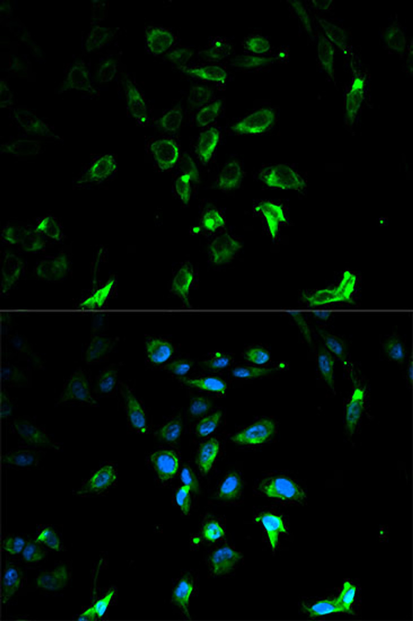 Immunofluorescence analysis of U2OS cells using STAR antibody (13-593) at dilution of 1:100. Blue: DAPI for nuclear staining.