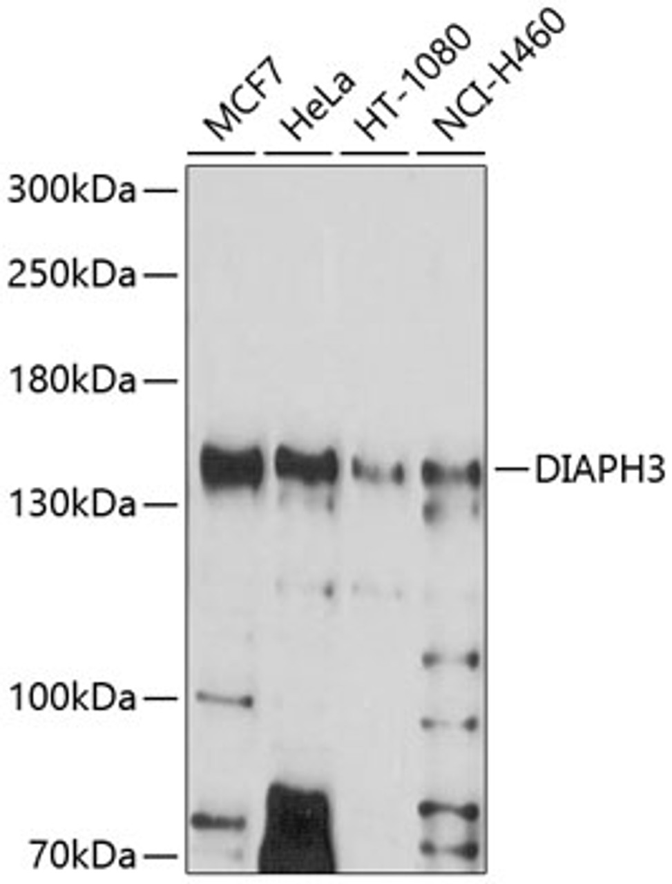Western blot analysis of extracts of various cell lines, using DIAPH3 antibody (13-595) at 1:1000 dilution.<br/>Secondary antibody: HRP Goat Anti-Rabbit IgG (H+L) at 1:10000 dilution.<br/>Lysates/proteins: 25ug per lane.<br/>Blocking buffer: 3% nonfat dry milk in TBST.<br/>Detection: ECL Basic Kit.<br/>Exposure time: 90s.