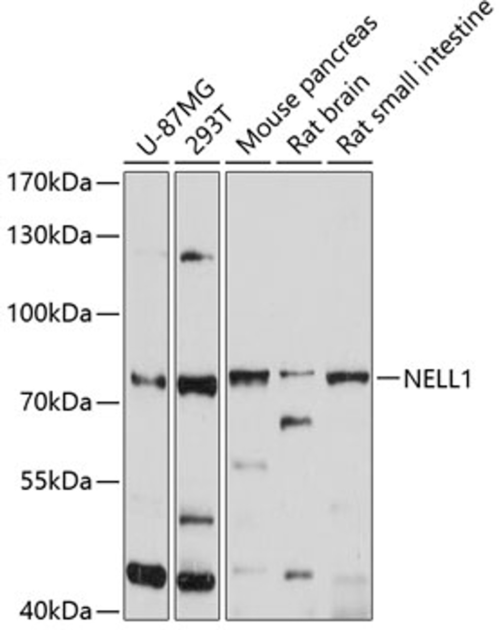 Western blot analysis of extracts of various cell lines, using NELL1 antibody (13-600) at 1:1000 dilution.<br/>Secondary antibody: HRP Goat Anti-Rabbit IgG (H+L) at 1:10000 dilution.<br/>Lysates/proteins: 25ug per lane.<br/>Blocking buffer: 3% nonfat dry milk in TBST.<br/>Detection: ECL Enhanced Kit.<br/>Exposure time: 10s.