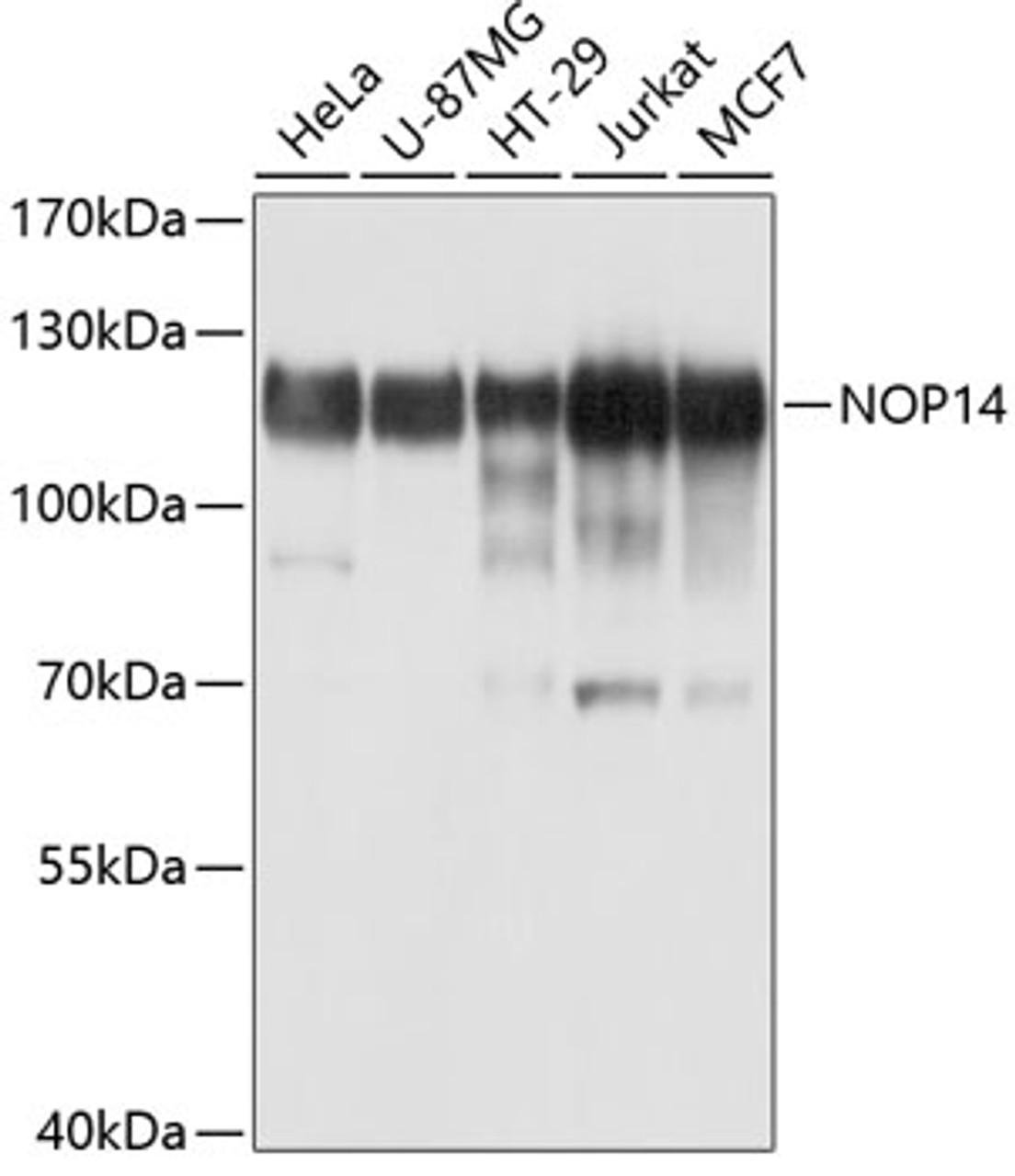 Western blot analysis of extracts of various cell lines, using NOP14 antibody (13-604) at 1:1000 dilution.<br/>Secondary antibody: HRP Goat Anti-Rabbit IgG (H+L) at 1:10000 dilution.<br/>Lysates/proteins: 25ug per lane.<br/>Blocking buffer: 3% nonfat dry milk in TBST.<br/>Detection: ECL Basic Kit.<br/>Exposure time: 1s.