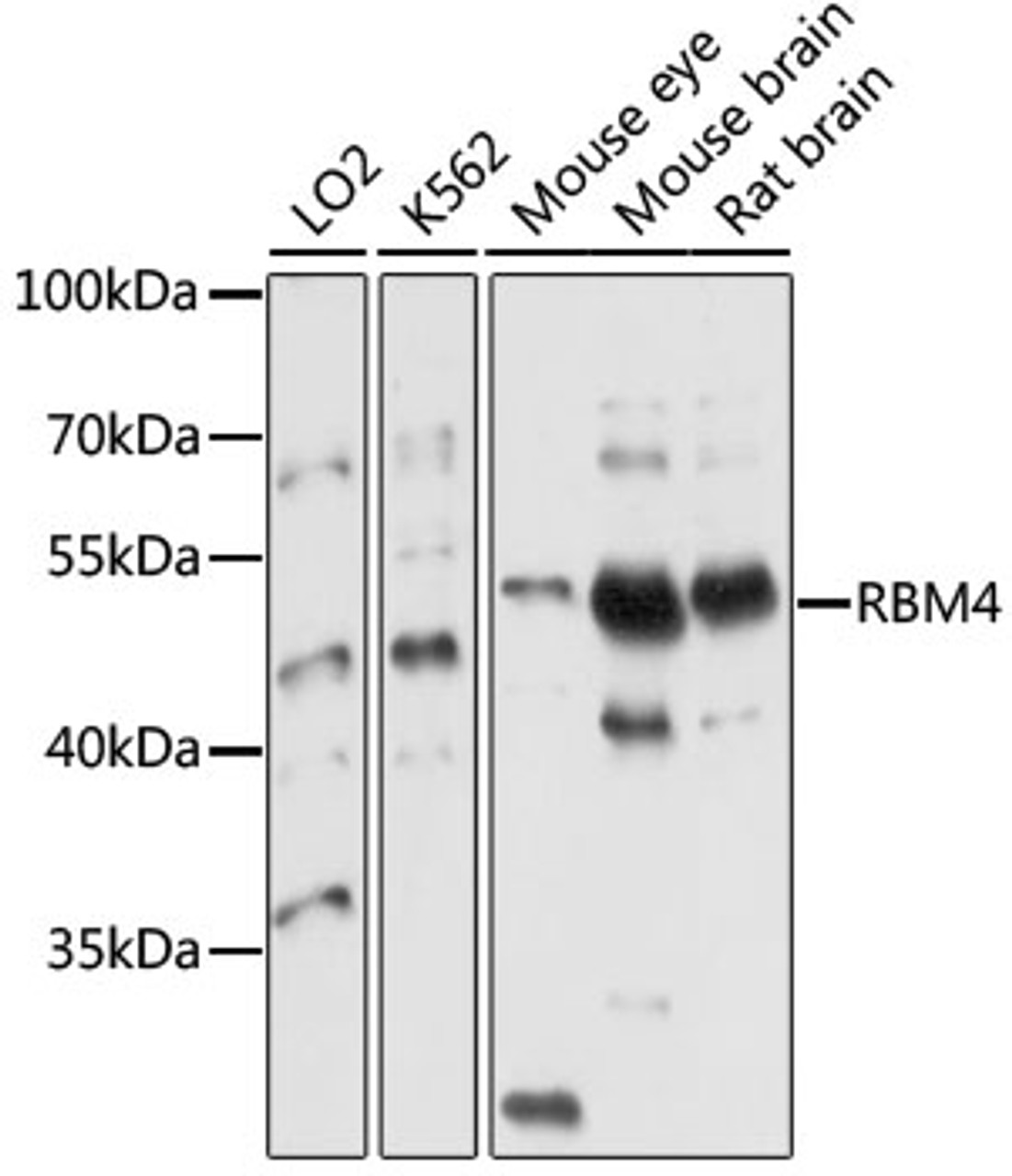 Western blot analysis of extracts of various cell lines, using RBM4 antibody (13-605) at 1:1000 dilution.<br/>Secondary antibody: HRP Goat Anti-Rabbit IgG (H+L) at 1:10000 dilution.<br/>Lysates/proteins: 25ug per lane.<br/>Blocking buffer: 3% nonfat dry milk in TBST.<br/>Detection: ECL Basic Kit.<br/>Exposure time: 10s.