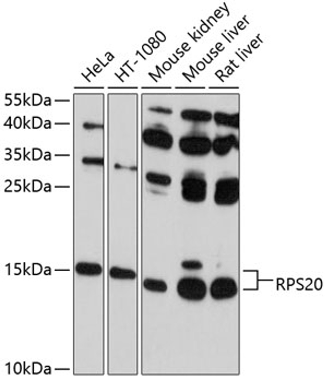 Western blot analysis of extracts of various cell lines, using RPS20 antibody (13-606) at 1:1000 dilution.<br/>Secondary antibody: HRP Goat Anti-Rabbit IgG (H+L) at 1:10000 dilution.<br/>Lysates/proteins: 25ug per lane.<br/>Blocking buffer: 3% nonfat dry milk in TBST.<br/>Detection: ECL Basic Kit.<br/>Exposure time: 60s.