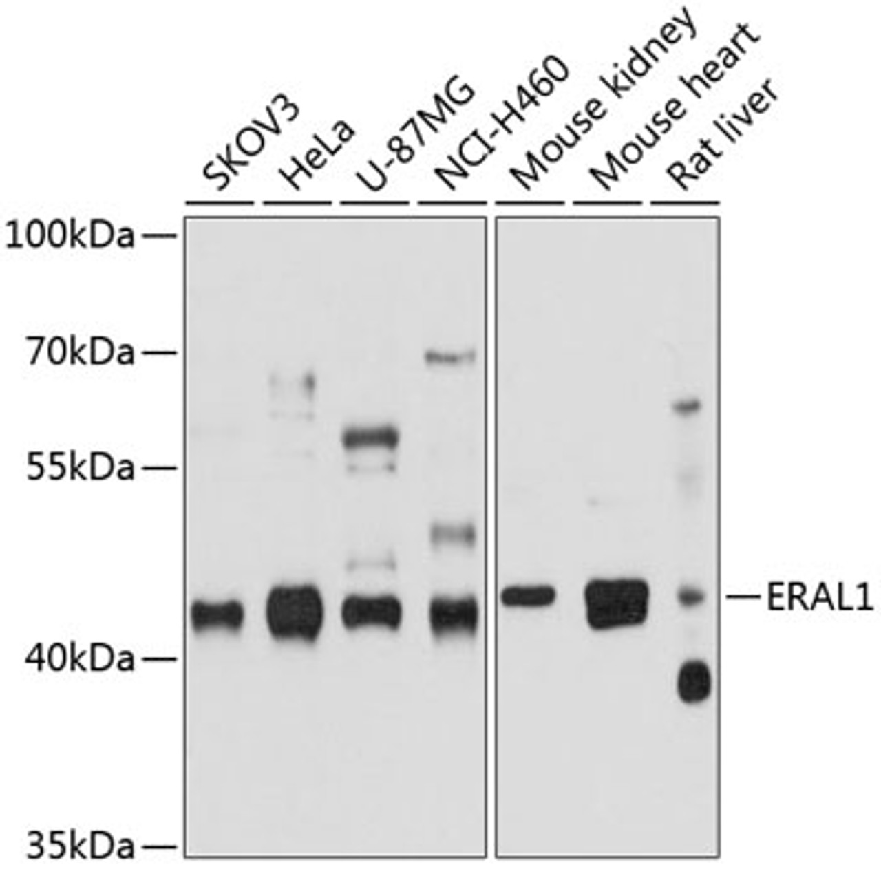 Western blot analysis of extracts of various cell lines, using ERAL1 antibody (13-618) at 1:1000 dilution.<br/>Secondary antibody: HRP Goat Anti-Rabbit IgG (H+L) at 1:10000 dilution.<br/>Lysates/proteins: 25ug per lane.<br/>Blocking buffer: 3% nonfat dry milk in TBST.<br/>Detection: ECL Basic Kit.<br/>Exposure time: 90s.
