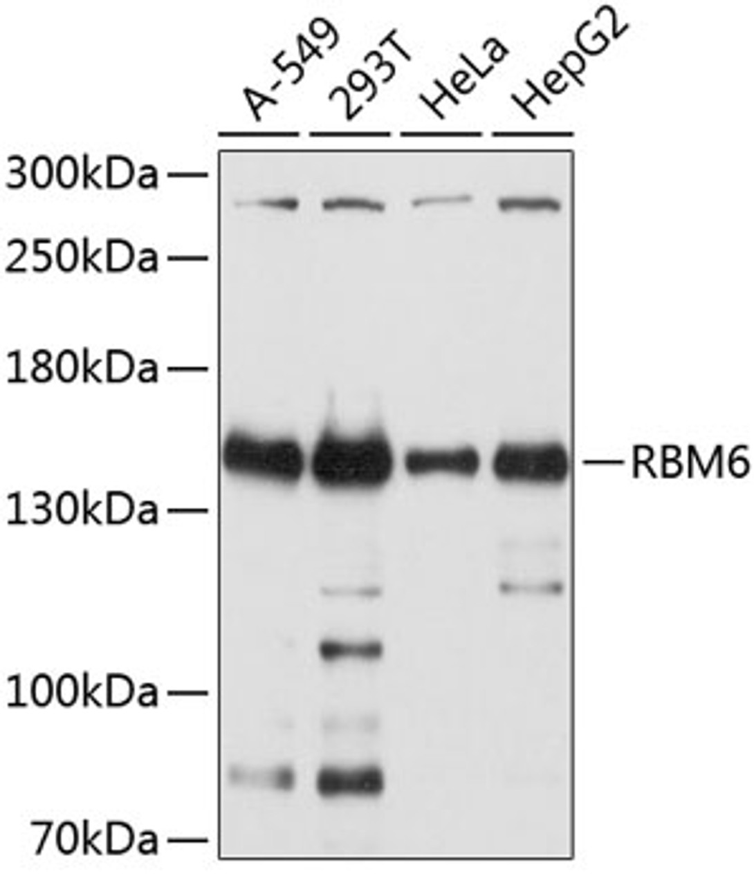 Western blot analysis of extracts of various cell lines, using RBM6 antibody (13-621) at 1:2000 dilution.<br/>Secondary antibody: HRP Goat Anti-Rabbit IgG (H+L) at 1:10000 dilution.<br/>Lysates/proteins: 25ug per lane.<br/>Blocking buffer: 3% nonfat dry milk in TBST.<br/>Detection: ECL Basic Kit.<br/>Exposure time: 5s.