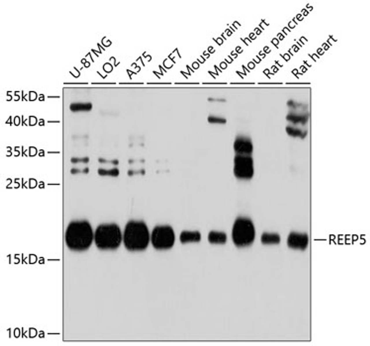 Western blot analysis of extracts of various cell lines, using REEP5 antibody (13-622) at 1:1000 dilution.<br/>Secondary antibody: HRP Goat Anti-Rabbit IgG (H+L) at 1:10000 dilution.<br/>Lysates/proteins: 25ug per lane.<br/>Blocking buffer: 3% nonfat dry milk in TBST.<br/>Detection: ECL Basic Kit.<br/>Exposure time: 1s.