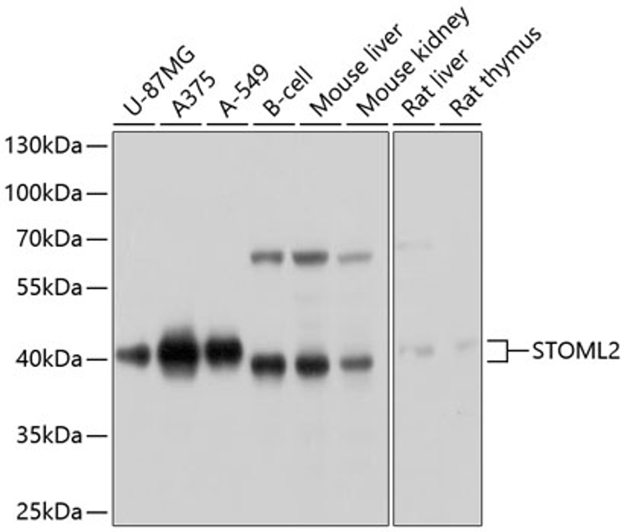 Western blot analysis of extracts of various cell lines, using STOML2 antibody (13-625) at 1:1000 dilution.<br/>Secondary antibody: HRP Goat Anti-Rabbit IgG (H+L) at 1:10000 dilution.<br/>Lysates/proteins: 25ug per lane.<br/>Blocking buffer: 3% nonfat dry milk in TBST.<br/>Detection: ECL Basic Kit.<br/>Exposure time: 10s.