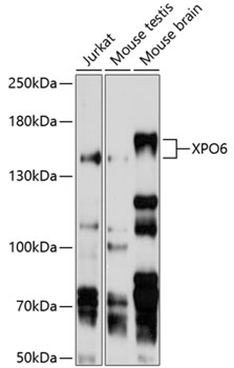 Western blot analysis of extracts of various cell lines, using XPO6 antibody (13-629) at 1:1000 dilution.<br/>Secondary antibody: HRP Goat Anti-Rabbit IgG (H+L) at 1:10000 dilution.<br/>Lysates/proteins: 25ug per lane.<br/>Blocking buffer: 3% nonfat dry milk in TBST.<br/>Detection: ECL Basic Kit.<br/>Exposure time: 5s.