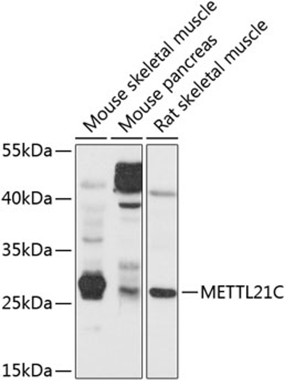 Western blot analysis of extracts of various cell lines, using METTL21C antibody (13-630) at 1:1000 dilution.<br/>Secondary antibody: HRP Goat Anti-Rabbit IgG (H+L) at 1:10000 dilution.<br/>Lysates/proteins: 25ug per lane.<br/>Blocking buffer: 3% nonfat dry milk in TBST.<br/>Detection: ECL Basic Kit.<br/>Exposure time: 10s.