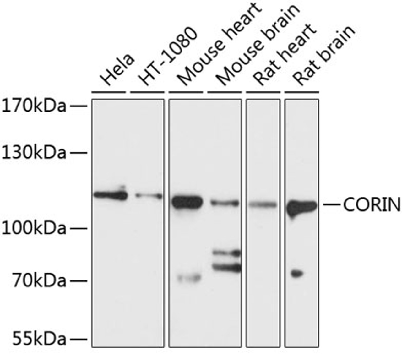 Western blot analysis of extracts of various cell lines, using CORIN antibody (13-631) at 1:1000 dilution.<br/>Secondary antibody: HRP Goat Anti-Rabbit IgG (H+L) at 1:10000 dilution.<br/>Lysates/proteins: 25ug per lane.<br/>Blocking buffer: 3% nonfat dry milk in TBST.<br/>Detection: ECL Basic Kit.<br/>Exposure time: 10s.