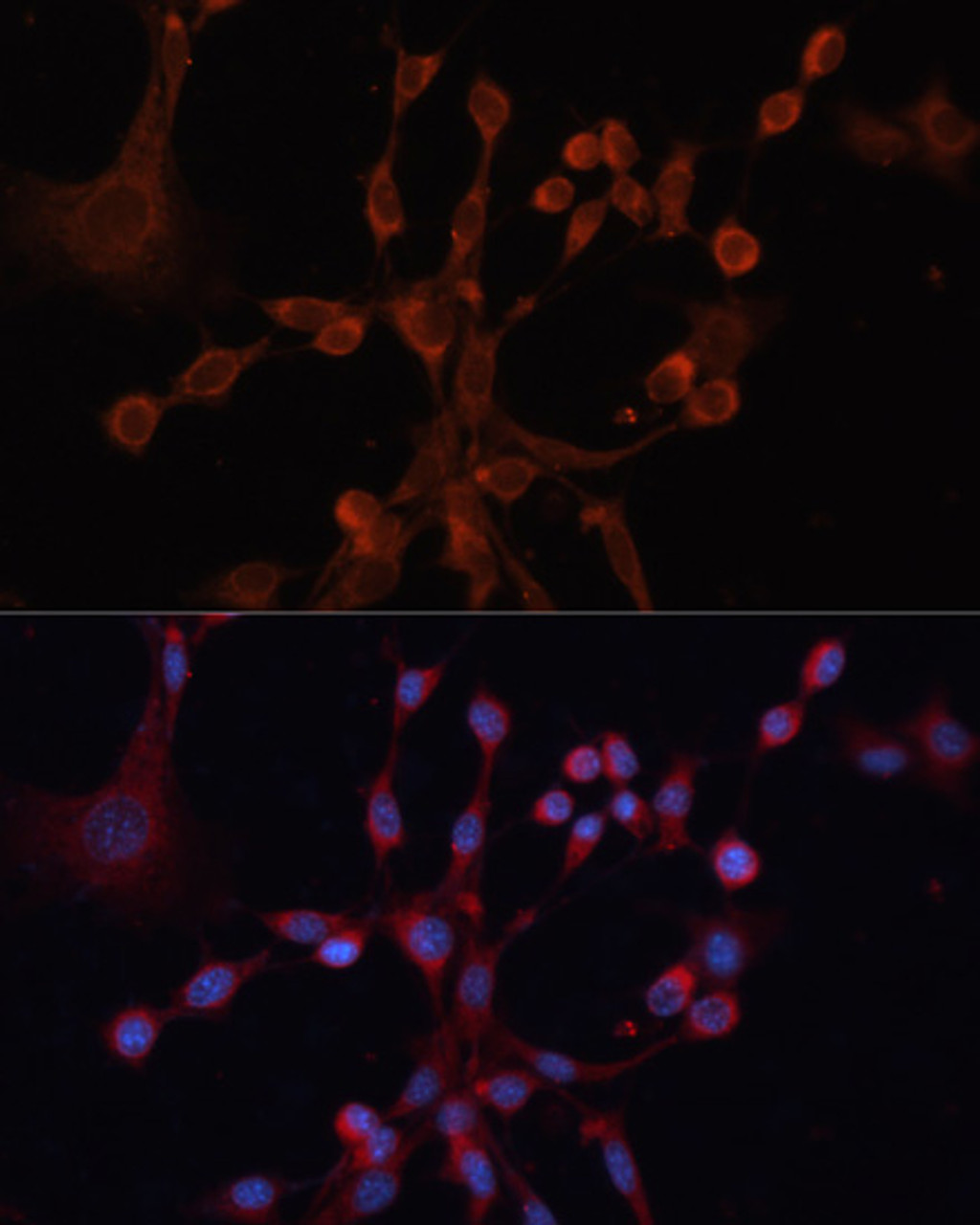 Immunofluorescence analysis of NIH/3T3 cells using GNA14 antibody (13-632) at dilution of 1:100. Blue: DAPI for nuclear staining.