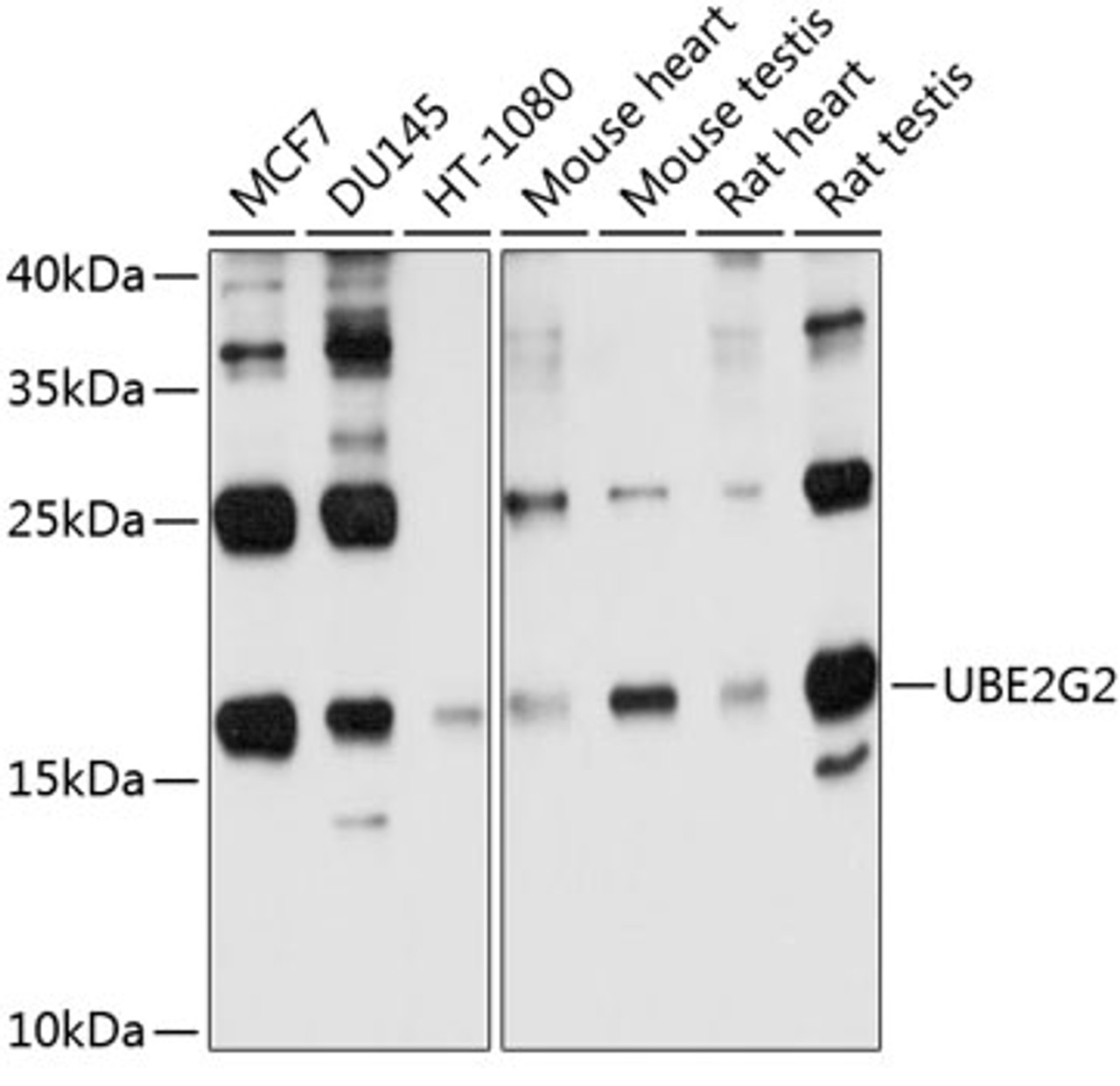 Western blot analysis of extracts of various cell lines, using UBE2G2 antibody (13-633) at 1:1000 dilution.<br/>Secondary antibody: HRP Goat Anti-Rabbit IgG (H+L) at 1:10000 dilution.<br/>Lysates/proteins: 25ug per lane.<br/>Blocking buffer: 3% nonfat dry milk in TBST.<br/>Detection: ECL Basic Kit.<br/>Exposure time: 30s.
