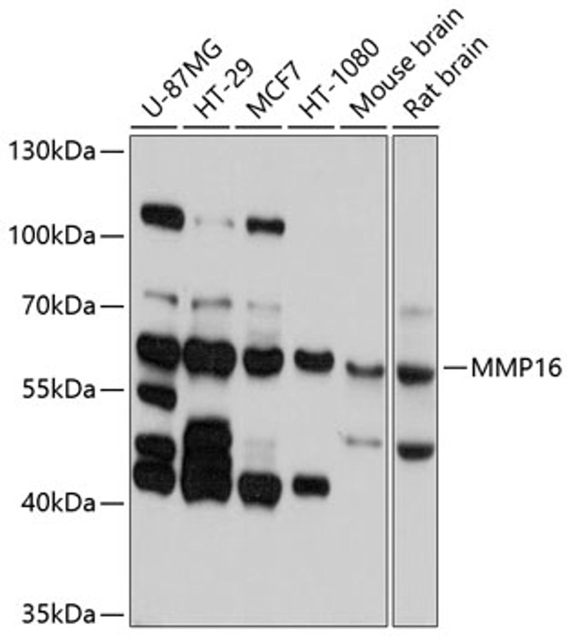 Western blot analysis of extracts of various cell lines, using MMP16 antibody (13-634) at 1:1000 dilution.<br/>Secondary antibody: HRP Goat Anti-Rabbit IgG (H+L) at 1:10000 dilution.<br/>Lysates/proteins: 25ug per lane.<br/>Blocking buffer: 3% nonfat dry milk in TBST.<br/>Detection: ECL Basic Kit.<br/>Exposure time: 10s.