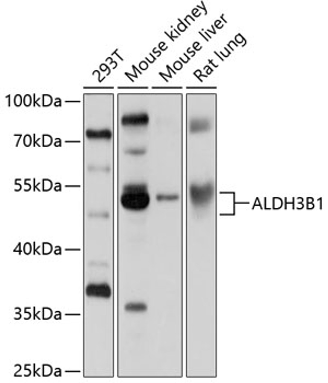 Western blot analysis of extracts of various cell lines, using ALDH3B1 antibody (13-636) at 1:1000 dilution.<br/>Secondary antibody: HRP Goat Anti-Rabbit IgG (H+L) at 1:10000 dilution.<br/>Lysates/proteins: 25ug per lane.<br/>Blocking buffer: 3% nonfat dry milk in TBST.<br/>Detection: ECL Basic Kit.<br/>Exposure time: 5s.