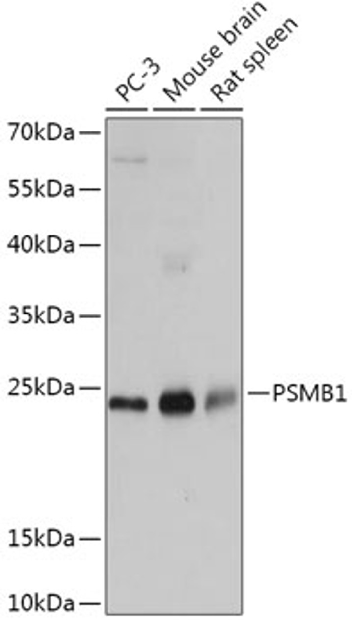 Western blot analysis of extracts of various cell lines, using PSMB1 antibody (13-643) at 1:1000 dilution.<br/>Secondary antibody: HRP Goat Anti-Rabbit IgG (H+L) at 1:10000 dilution.<br/>Lysates/proteins: 25ug per lane.<br/>Blocking buffer: 3% nonfat dry milk in TBST.<br/>Detection: ECL Basic Kit.<br/>Exposure time: 1s.