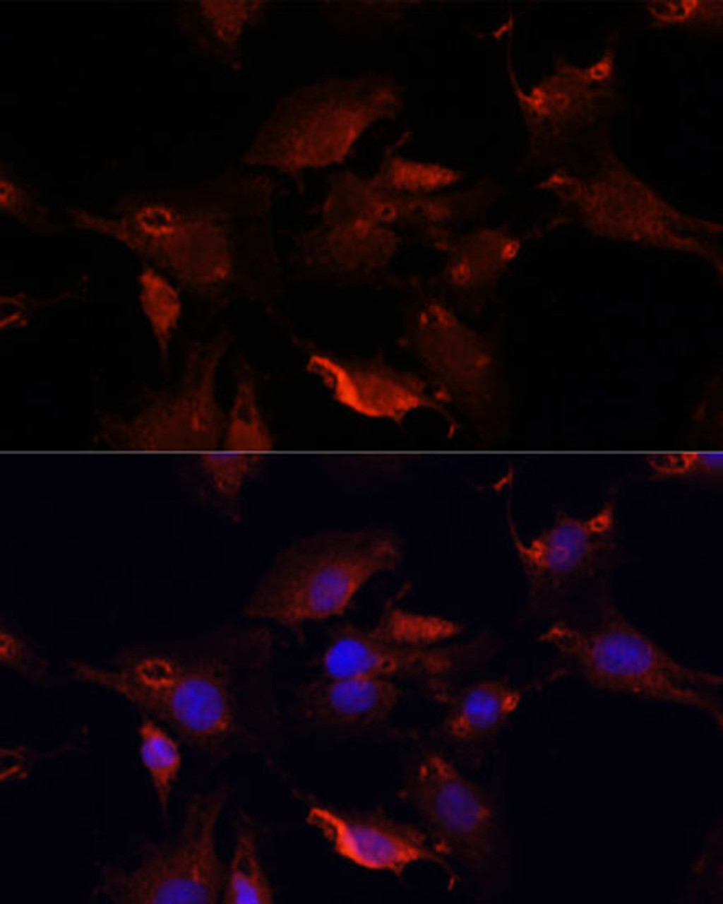 Immunofluorescence analysis of C6 cells using TYMS antibody (13-651) at dilution of 1:100. Blue: DAPI for nuclear staining.