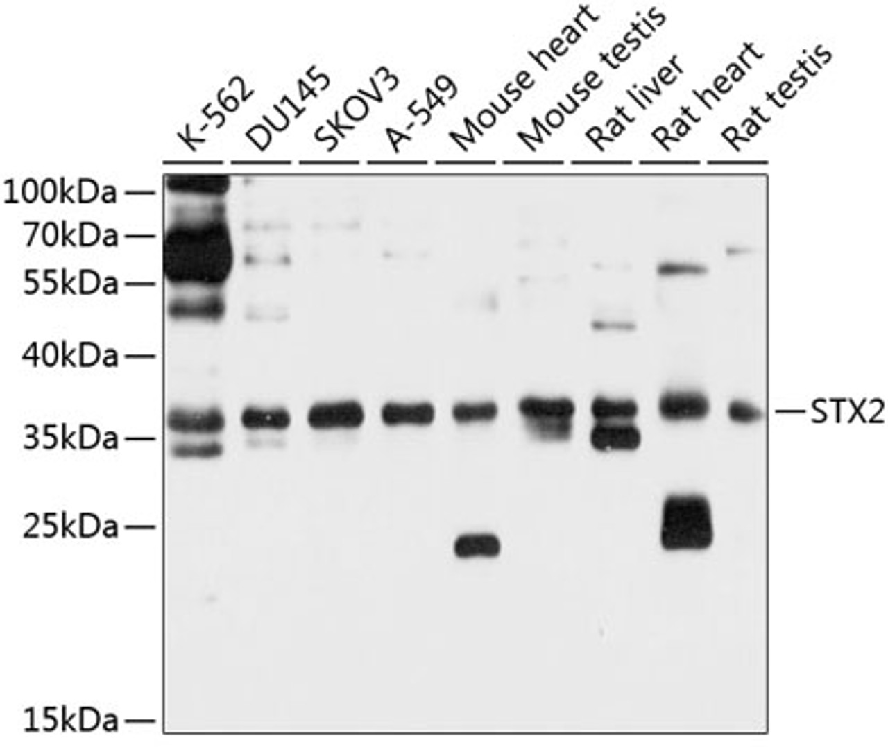 Western blot analysis of extracts of various cell lines, using STX2 antibody (13-653) at 1:1000 dilution.<br/>Secondary antibody: HRP Goat Anti-Rabbit IgG (H+L) at 1:10000 dilution.<br/>Lysates/proteins: 25ug per lane.<br/>Blocking buffer: 3% nonfat dry milk in TBST.<br/>Detection: ECL Basic Kit.<br/>Exposure time: 10s.